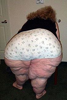 Cette femme soufre d'obésité morbide!!!